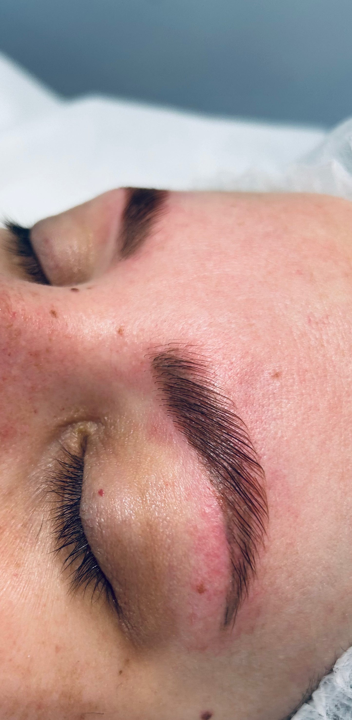 Botox pour le BROW/LUSH LIFT